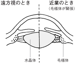 近業のときは毛様体が緊張します。