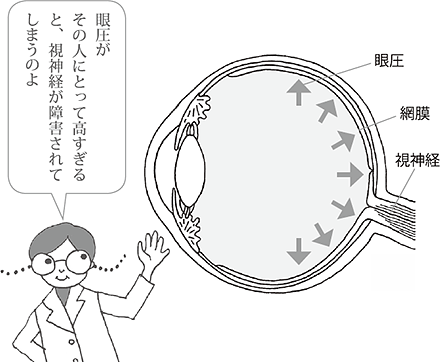 眼圧がその人にとって高すぎると、視神経が障害されてしまいます