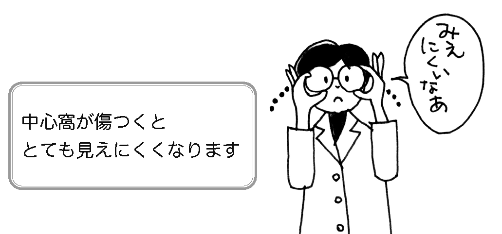 中心窩が傷つくととても見えにくくなります